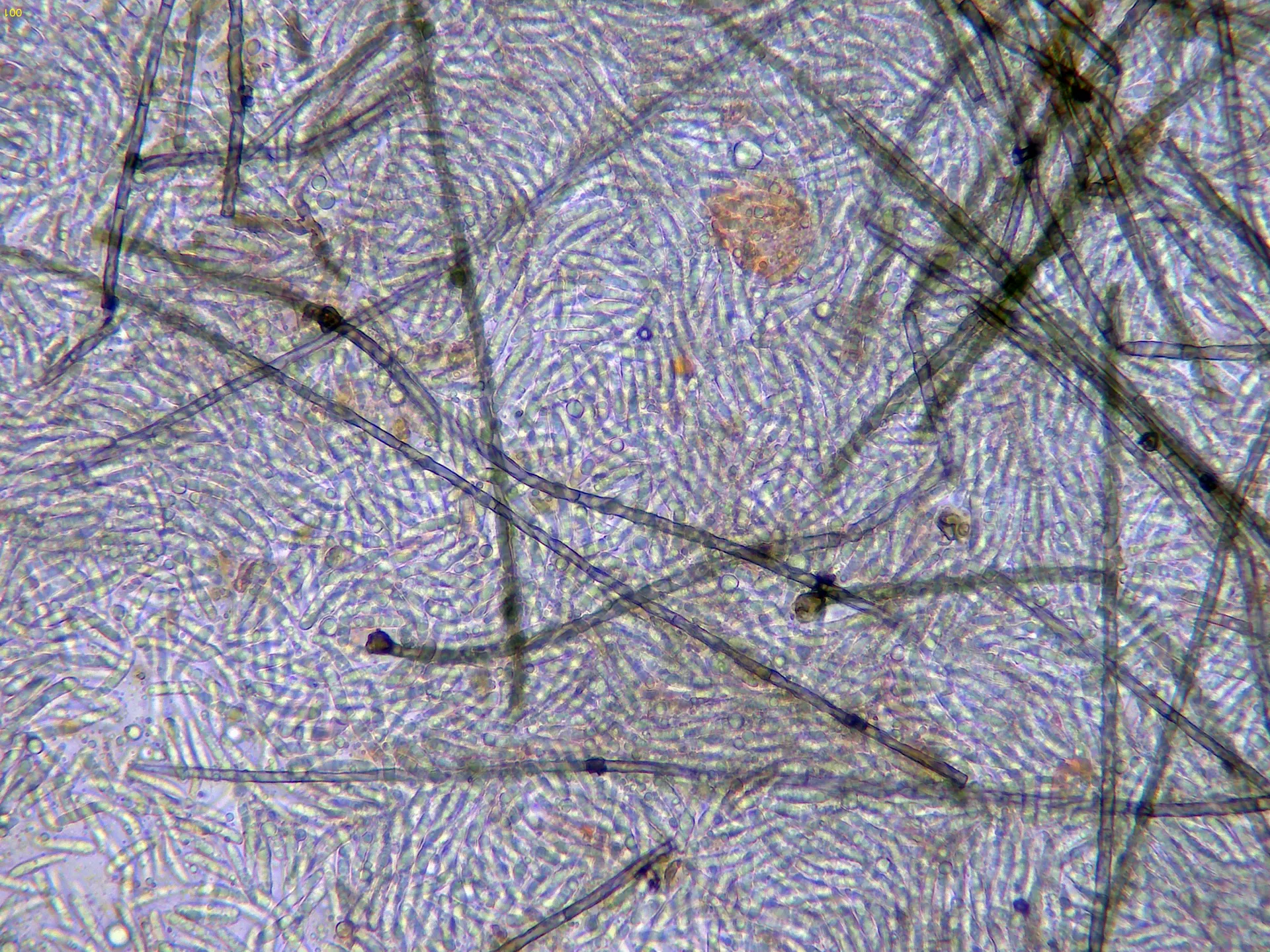 Microscopía de Menispora ciliata - 15 - Hifas conidiógenas x 400-001